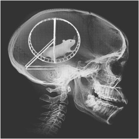 My Latest Head MRI